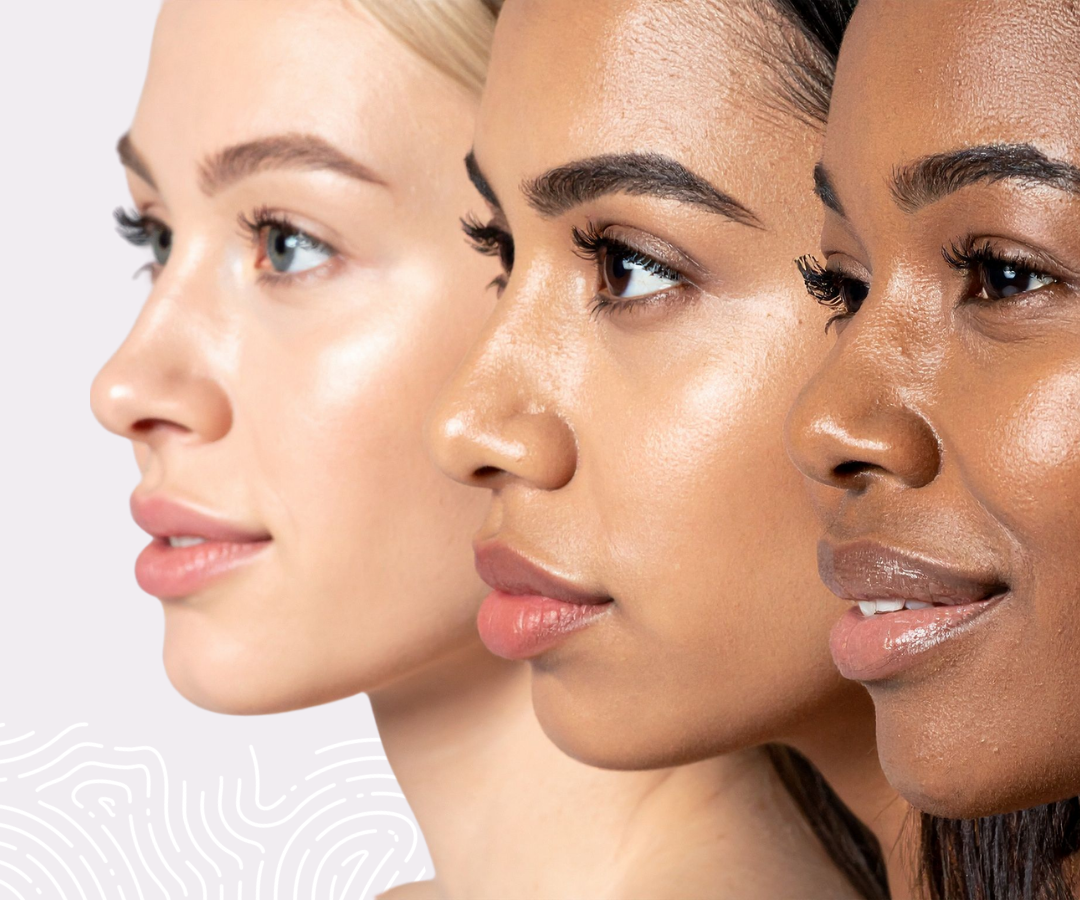 Skin Type vs. Skin Condition: Understanding Your Skin